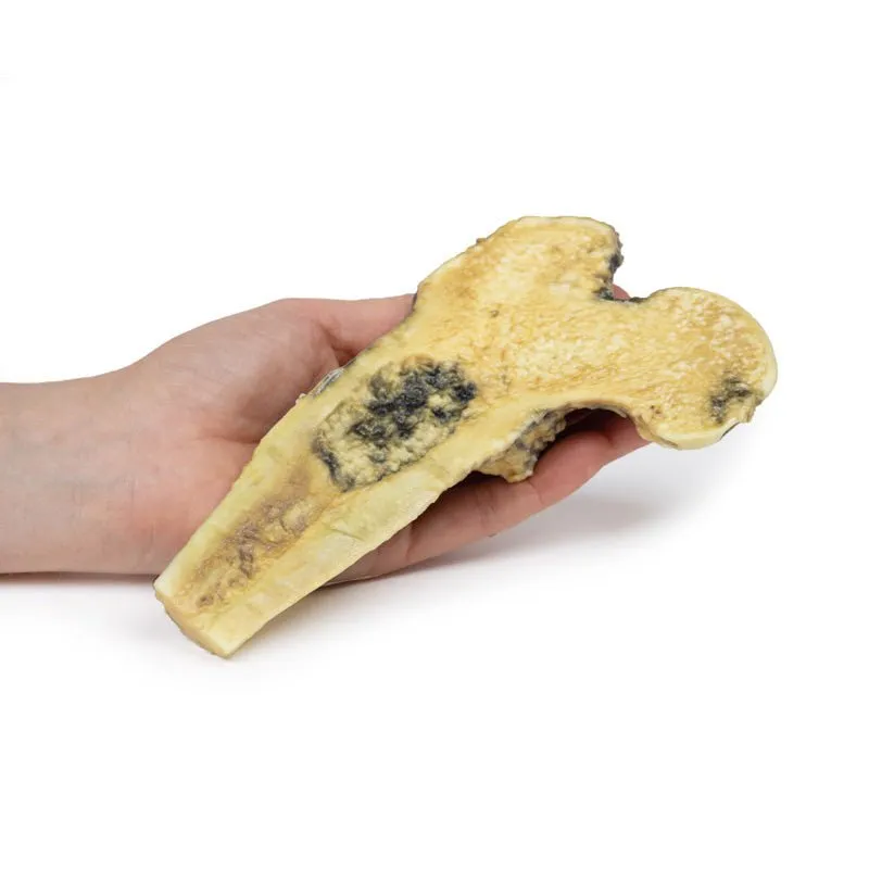 3D Printed Chondrosarcoma